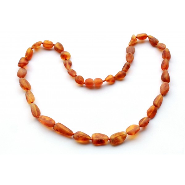 Raw-Amber-Necklace